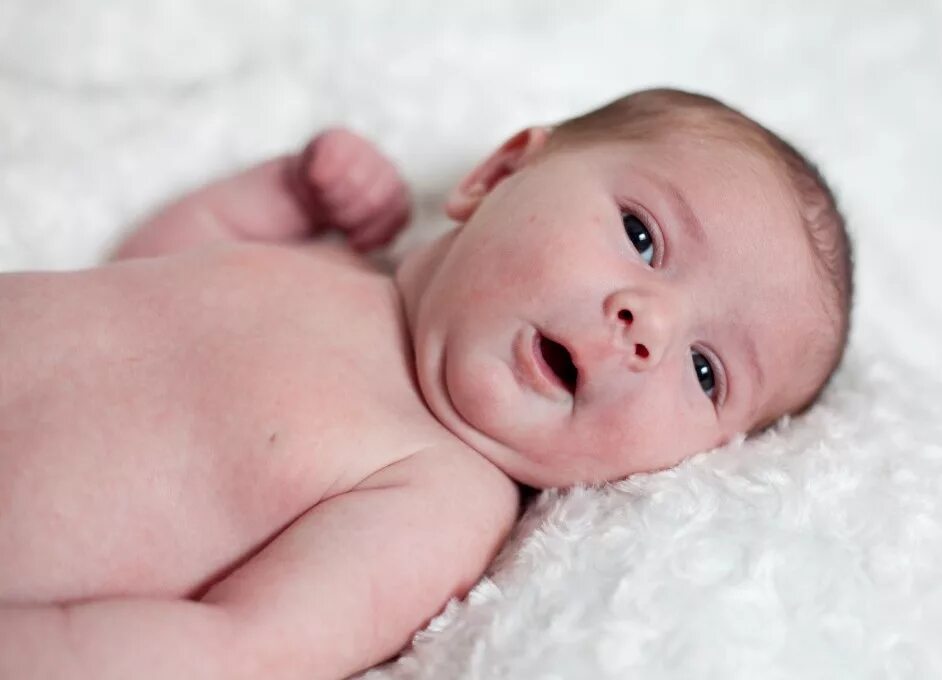 Детский кожный. Цвет кожи у новорожденных. Мраморная кожа у новорожденных. Нормальный цвет кожи новорожденного ребенка.