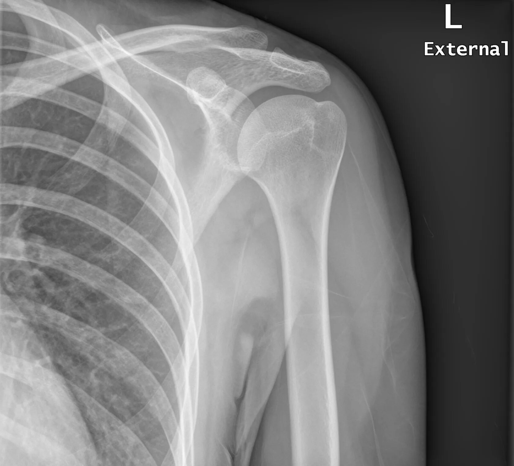 Source x rays