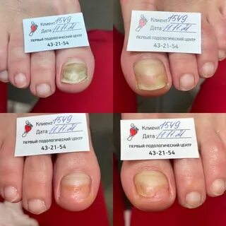 Первый подологический центр