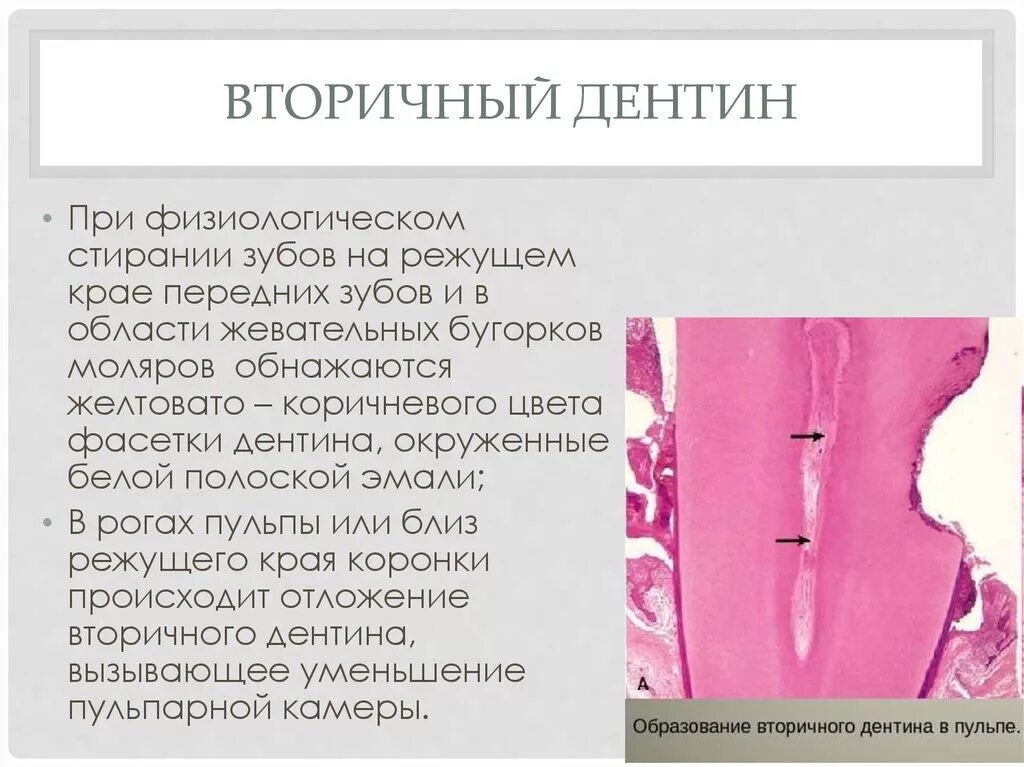 Дентин формируется. Интертубулярный дентин гистология. первичный и вторичный дентин. формирование вторичного дентина. строение дентина.