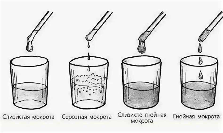 Отхаркивание мокроты по утрам. Отхаркивание мокроты по утрам