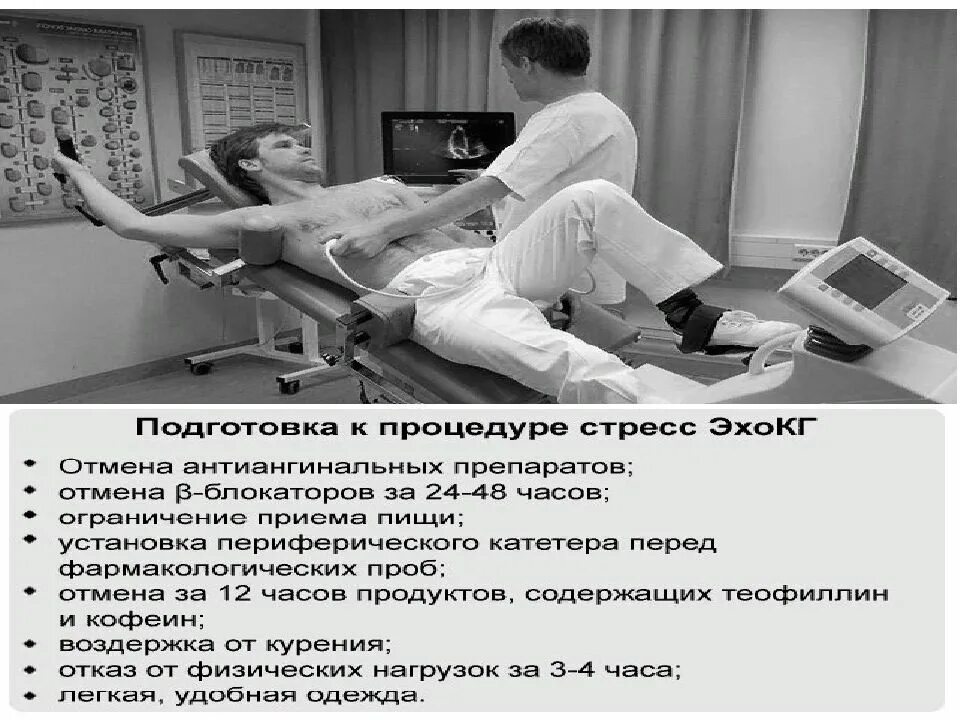 Стресс эхокг с добутамином противопоказания. Методика проведения стресс эхокардиографии. Стресс эхо экг. Стресс эхокг методика. Стресс эхокг методика проведения.