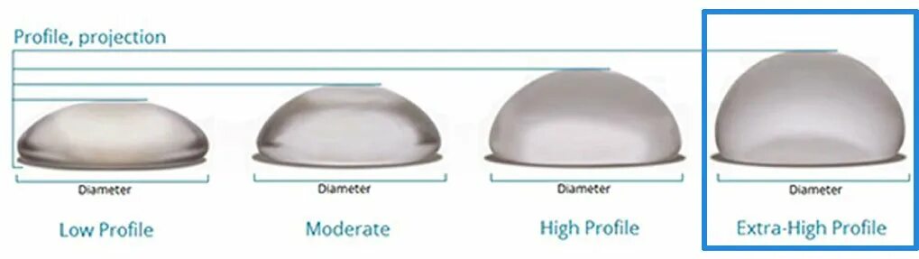 Грудной имплант 800 мл. Грудные импланты ментор анатомические. Импланты грудные круглые высокий профиль. Импланты ментор высокий профиль. Круглые импланты ментор.