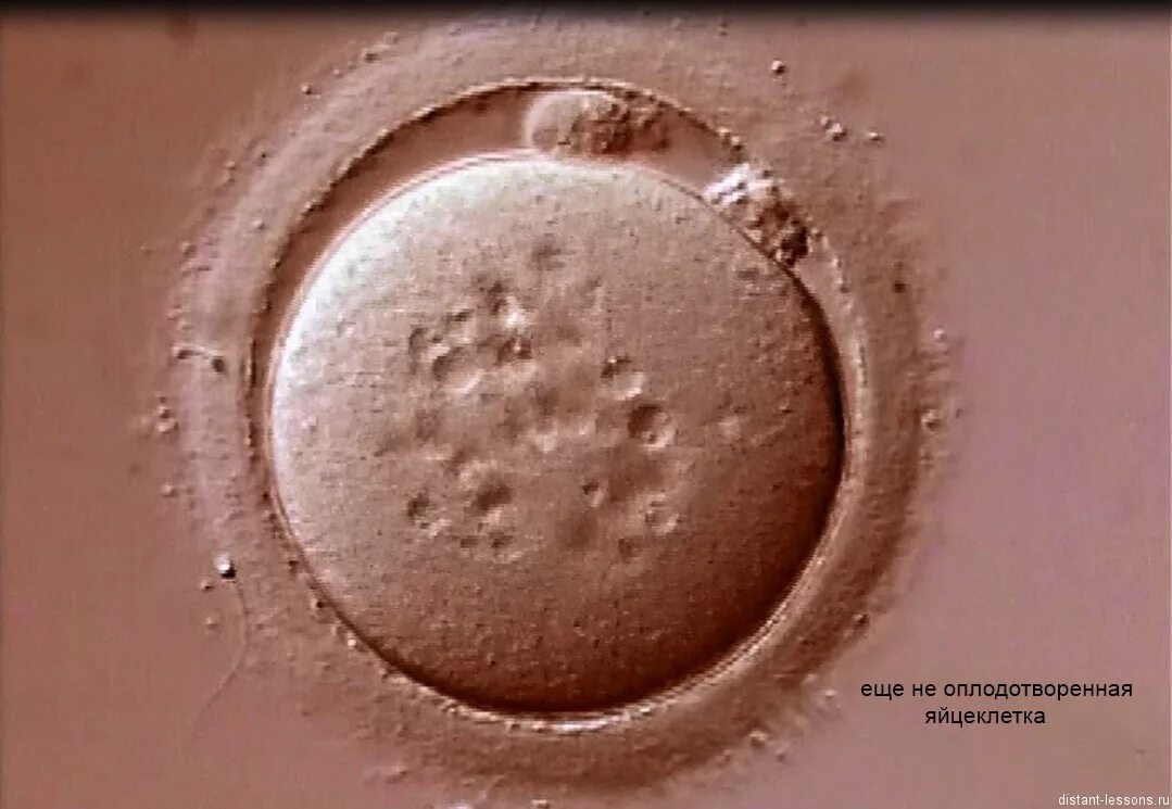 После оплодотворения яйцеклетки и первых. Оплодотворенная яйцеклетка. Яйцеклетка в микроскопе. Яйцеклетка под микроскопом.