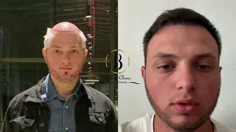 Хованский пересадил