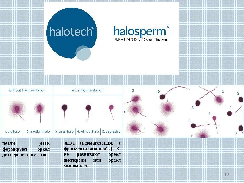 Фрагментация днк методы. Расшифровка фрагментации ДНК спермограммы. Фрагментация ДНК сперматозоидов (метод tunel). ДНК фрагментация сперматозоидов расшифровка. Фрагментация ДНК сперматозоидов показатели нормы.