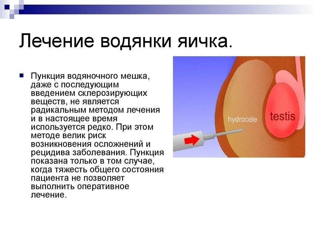 Водянка яичек у новорожденных мальчиков