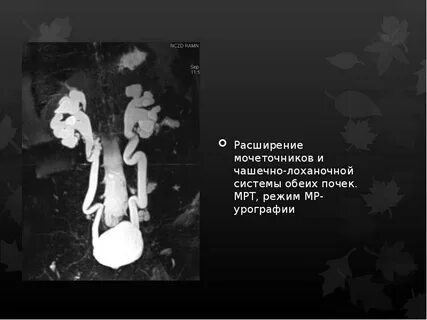 Расширение члс