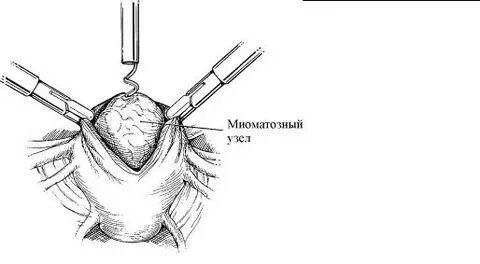 После удаления узлов