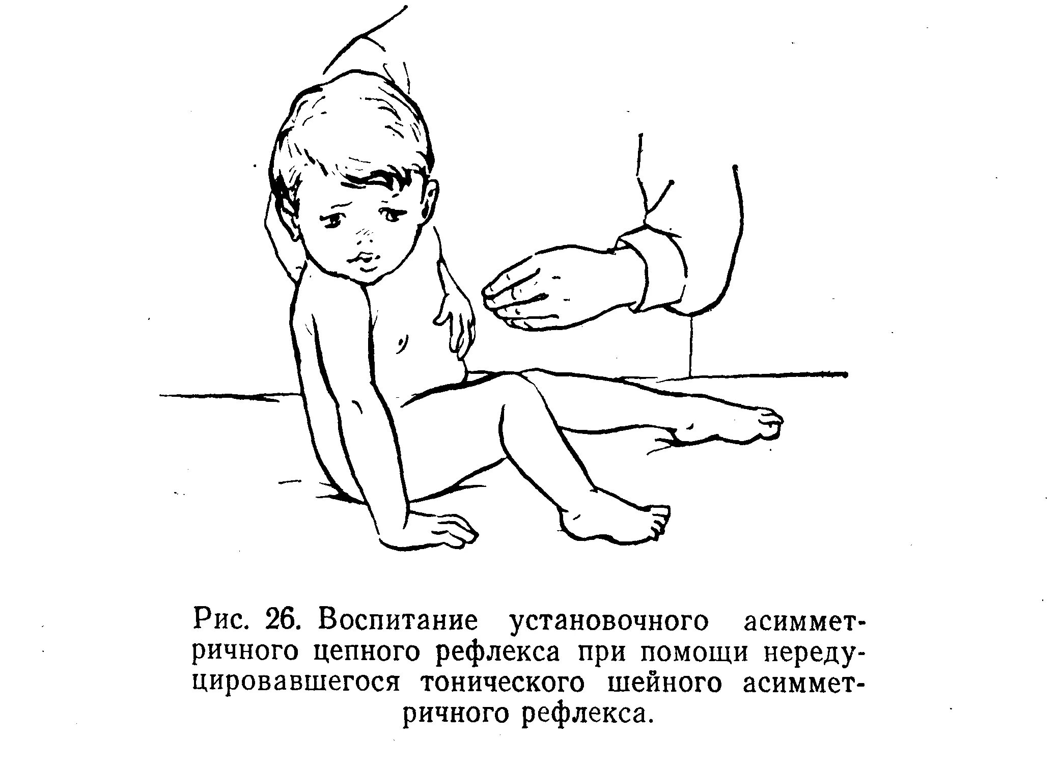 Методика массажа ребенка. Рефлексы при ДЦП. Методика массажа при ДЦП. Массаж при детском церебральном параличе. Установочные рефлексы у детей.