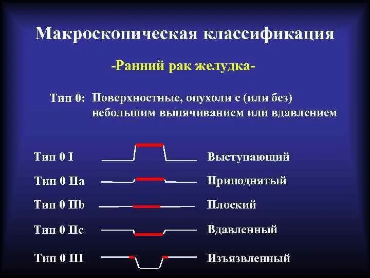 Тип 0 is. Полиповидные новообразования классификация. Классификация новообразований желудка. Опухоли желудка классификация. Эндоскопическая классификация новообразований желудка.