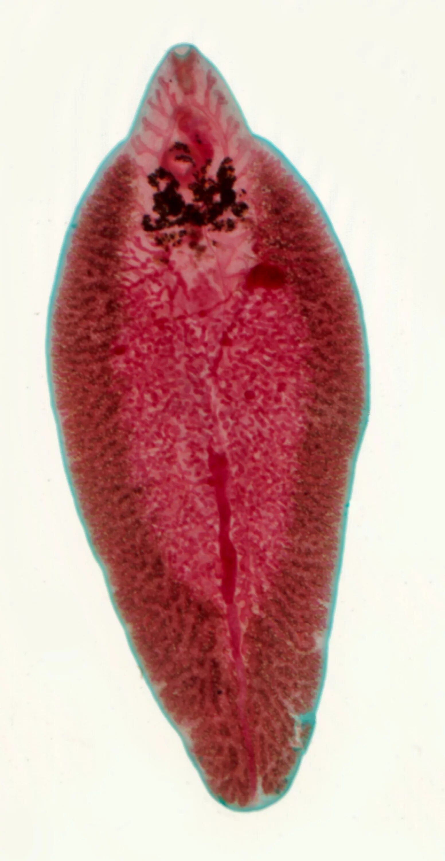 Печеночный сосальщик фасциола. Трематоды Fasciola hepatica. Fasciola hepatica препарат. Сосальщик печеночный hepatica.