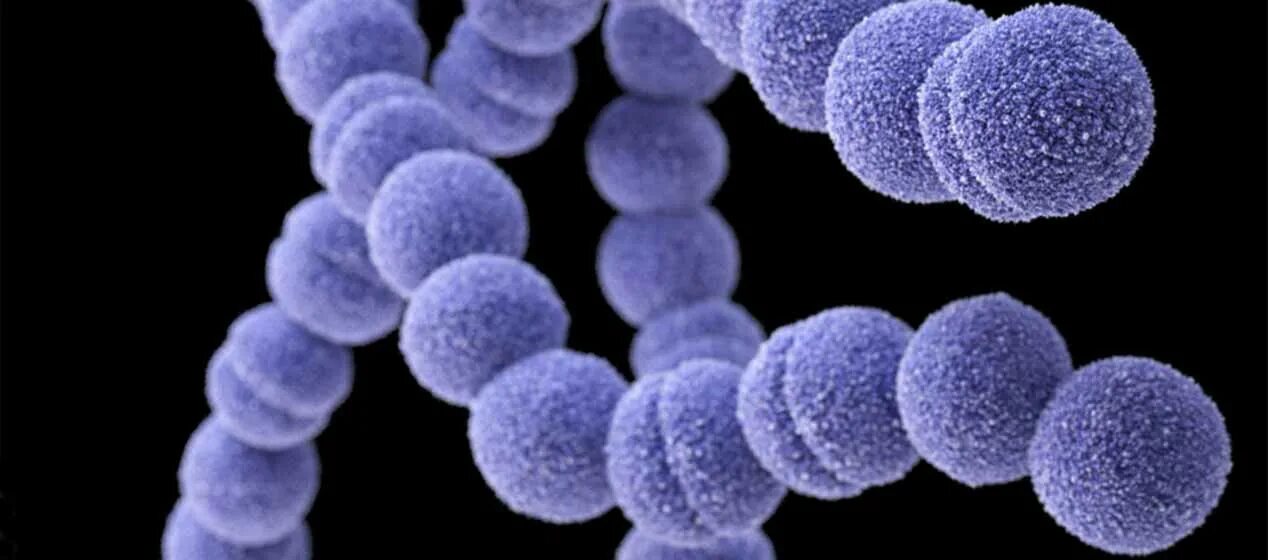 Streptococcus