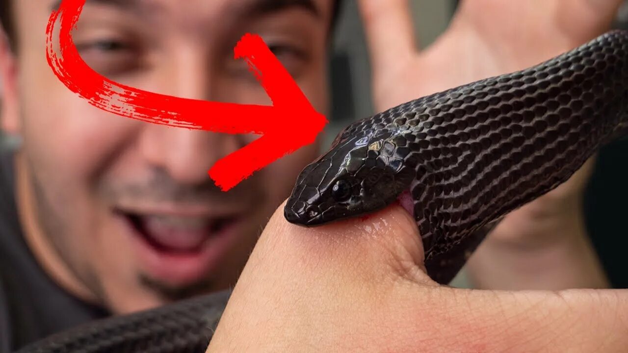 Snake bites. WCGW stop Snake.