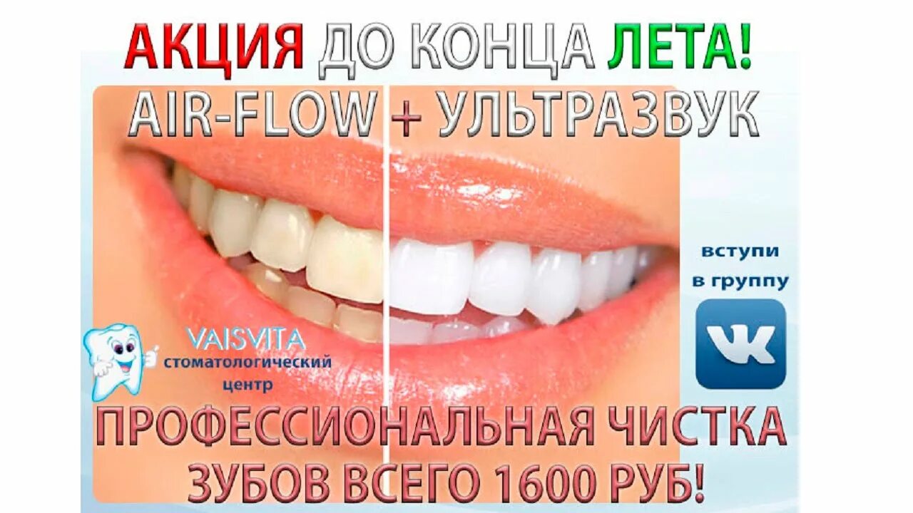 Вставить зубы в иркутске