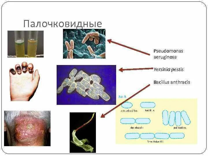 Экология микроорганизмов схема. Распространение микроорганизмов в окружающей среде. Распространение микроорганизмов в окружающей среде схема. Экология микроорганизмов.