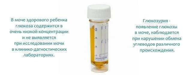 Сбор мочи на сахар алгоритм. Глюкоза в моче. исследование мочи на глюкозу. методика определения сахара в суточной моче. исследование суточной мочи на сахар.