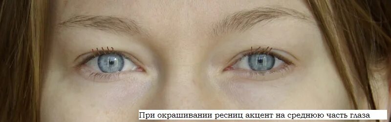 Макияж для нависающего верхнего века. Один глаз нависший другой. Нависает верхнее веко на один глаз. Один глаз нависший другой. Нависание века на одном глазу.