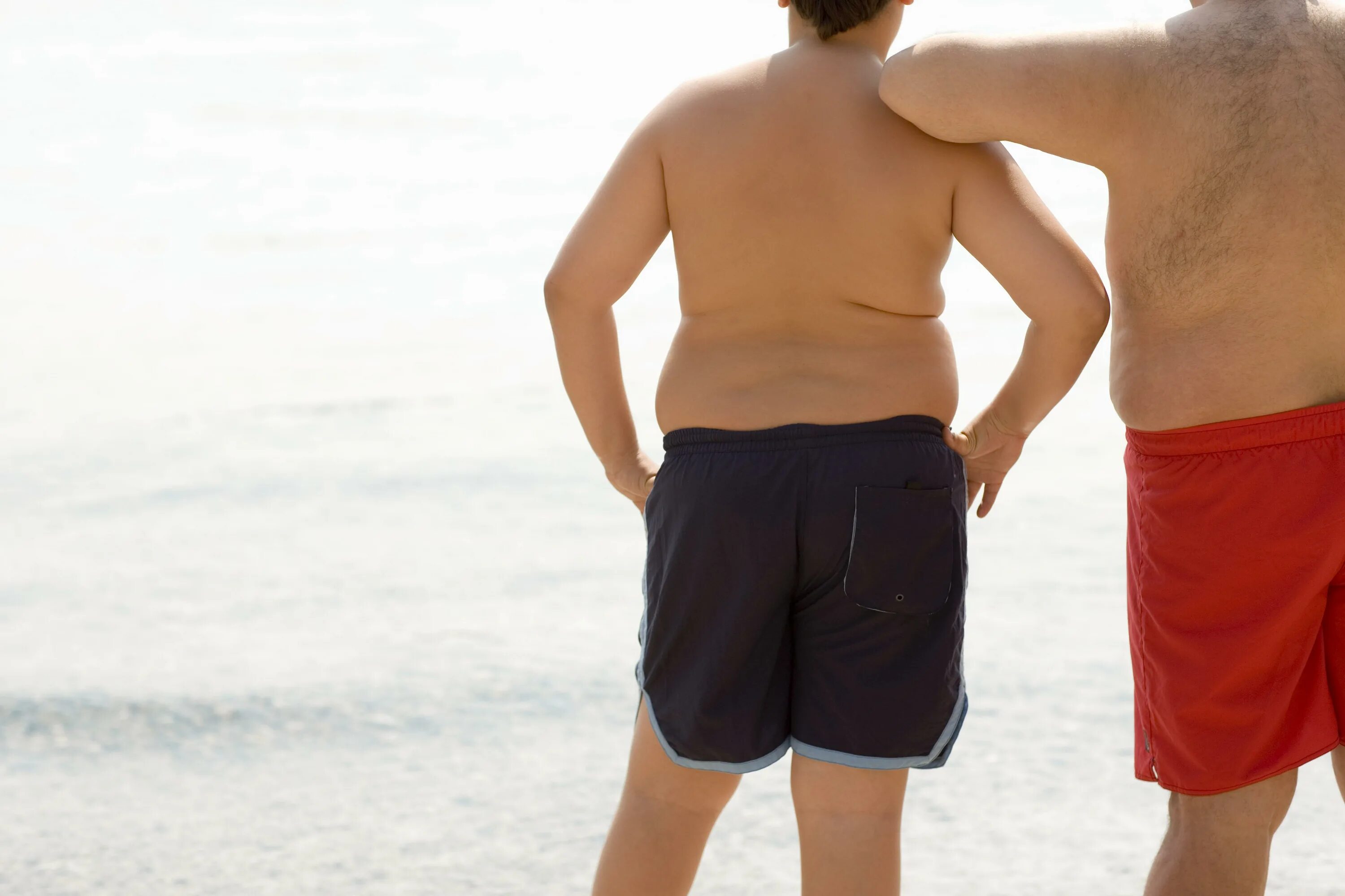 Ожирение у подростка мальчика. Ожирение у мальчиков 12 лет. Дети с ожирением на пляже.