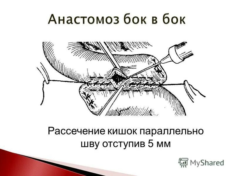 Книга рассечение стоуна