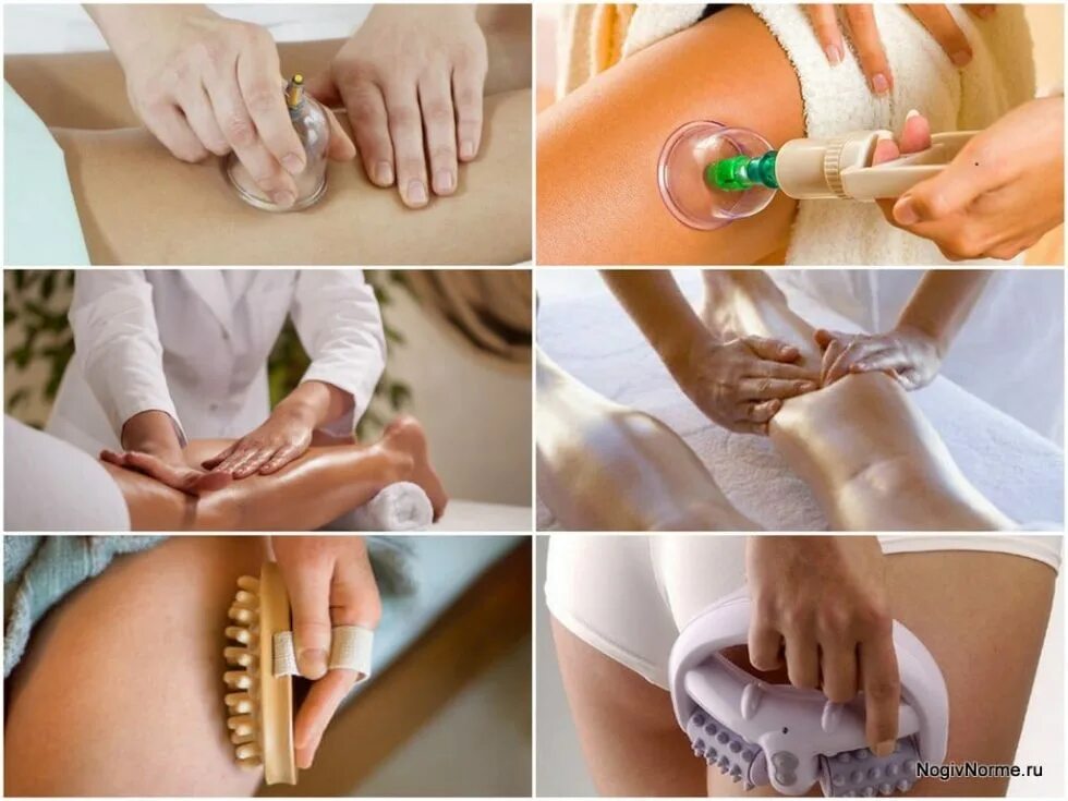 Антицеллюлитный лимфодренажный массаж. Если делать массаж каждый день. Общий массаж тела. Массаж. Массаж техника выполнения.