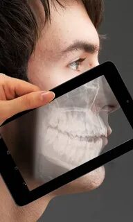 Скачай приложение x ray