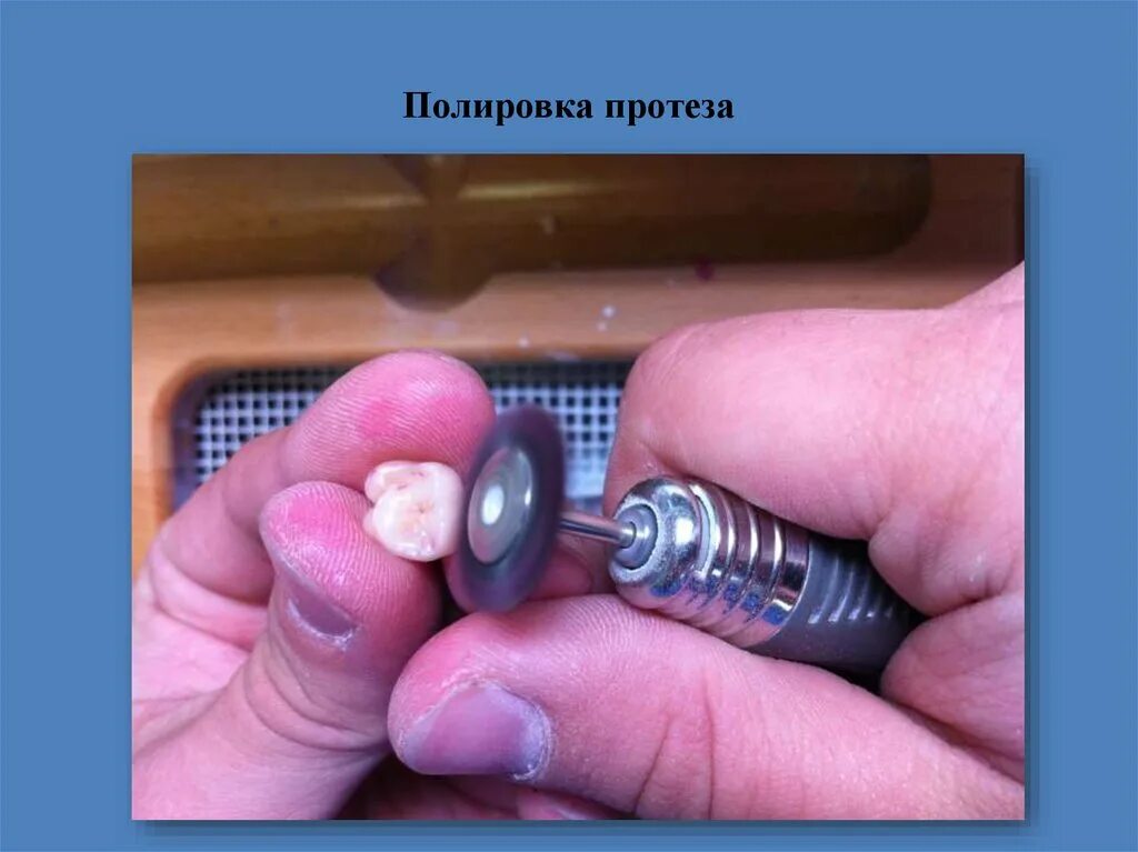 Обработка шлифовка полировка. Полировка для пластмассовых протезов. шлифовка полировка протеза. полировка мостовидного протеза.