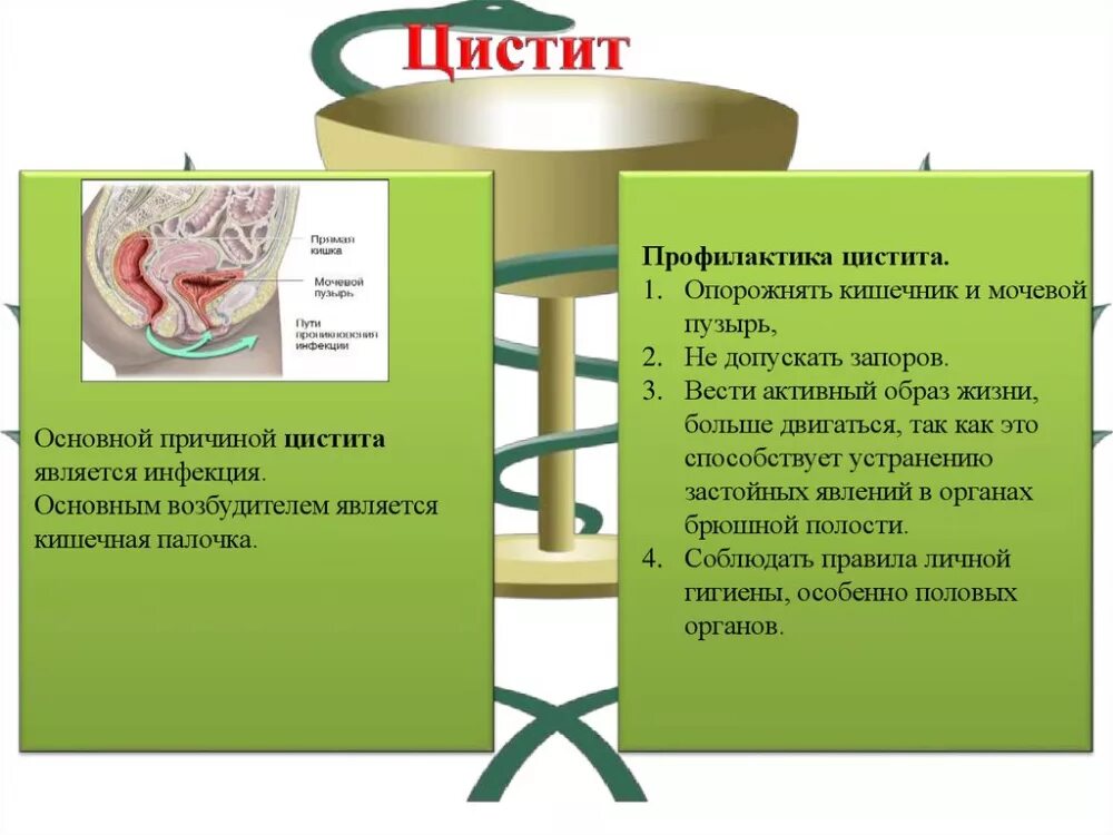 Что делать если цистит начался. Профилактика цистита. Профилактика от цистита. Профилактика цистита у женщин. Цистит симптомы и профилактика.