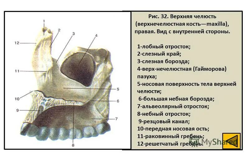 Клыковую ямку. Небный отросток верхней челюсти анатомия. Строение верхнечелюстной кости черепа человека. Строение кости верхней челюсти. Верхняя челюсть анатомия строение костей.