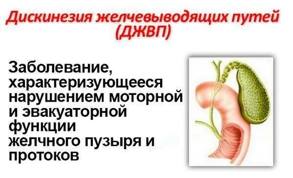 Дискинезия желчевыводящих путей это простыми словами. Дискинезия желчевыводящих путей. Дискинезия желчевыводящих путей (джвп). Дискинезия желчного пузыря. Дискинезия желчных протоков.