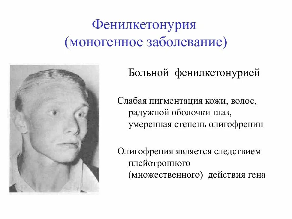 Фенилкетонурия моногенное заболевание возникающее в результате. Фенилкетонурия фенотипическая характеристика. Фенилкетонурия основные симптомы. Характерные признаки фенилкетонурии. Фенилкетонурия это наследственное заболевание.