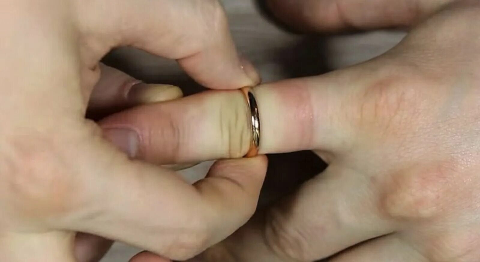 Снять кольцо с отекшего пальца. Как снять кольцо с опухшего пальца видео