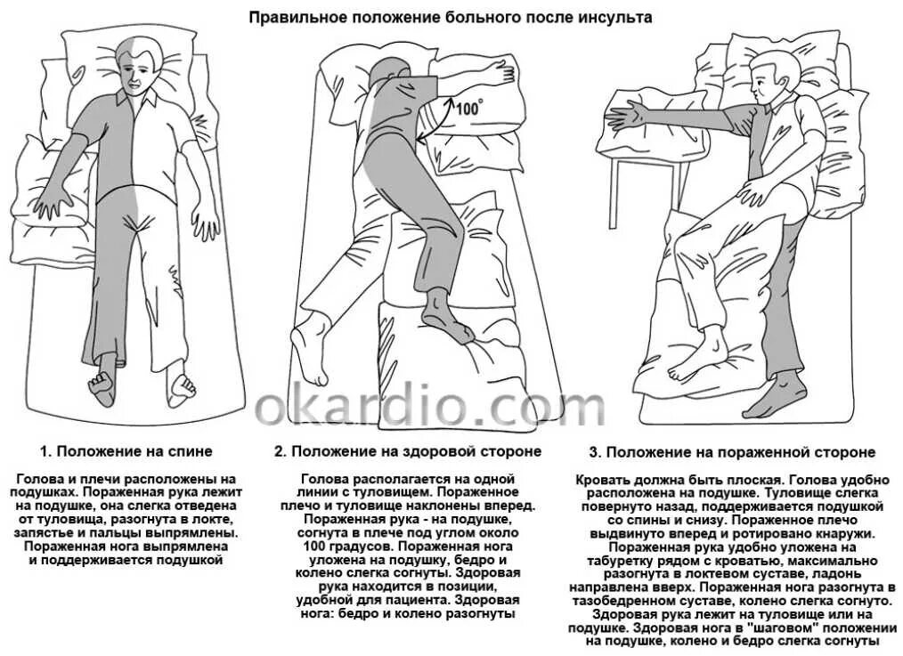 Положение картинка. Массаж при параличе правой стороны после инсульта. Положение больного после инсульта. Укладка пациентов после инсульта. Поза лежачего больного после инсульта.