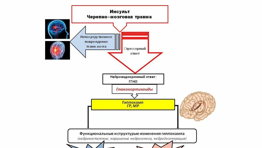 Когнитивные нарушения инсульт