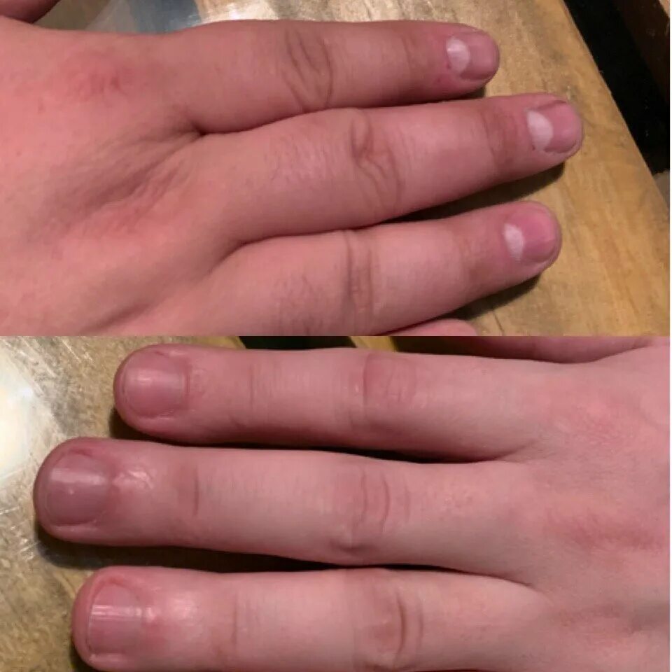 Мужские ногти неухоженные. Неухоженные мужские руки.