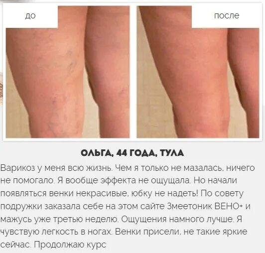 Змеетоник отзывы. Змеетоник вено. маз змеетоник вен +. змеетоник вено плюс. змеетоник вено плюс гель.
