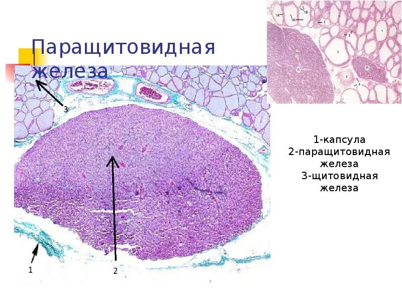 Паращитовидная гистология. Паращитовидная железа гистология препарат. околощитовидная железа гистология препарат. строение паращитовидной железы гистология. околощитовидная железа строение гистология.