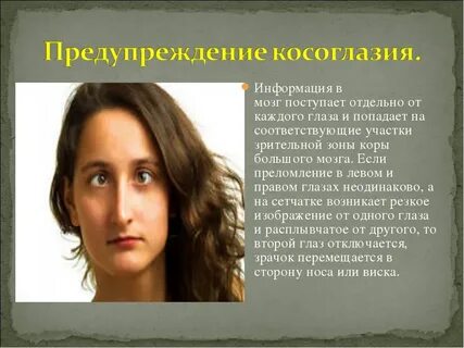 Можно ли косоглазием