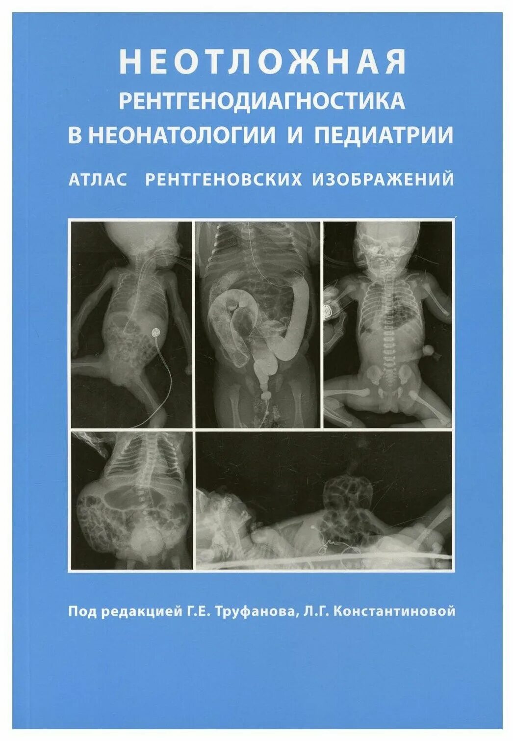 Неотложная рентгенодиагностика. Развитие неонатологии. Неонатология книги. Новорожденный ребенок и врач. Неотложная рентгенодиагностика.