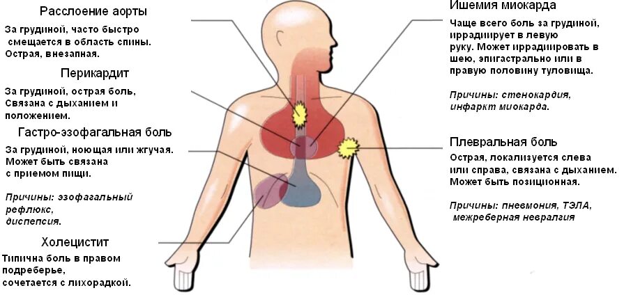 Больно дышать. Болит посередине грудины спереди. Болит верхняя часть грудной клетки посередине спереди. Боль в грудной клетке посередине причины. Болит сердце посередине грудной клетки.