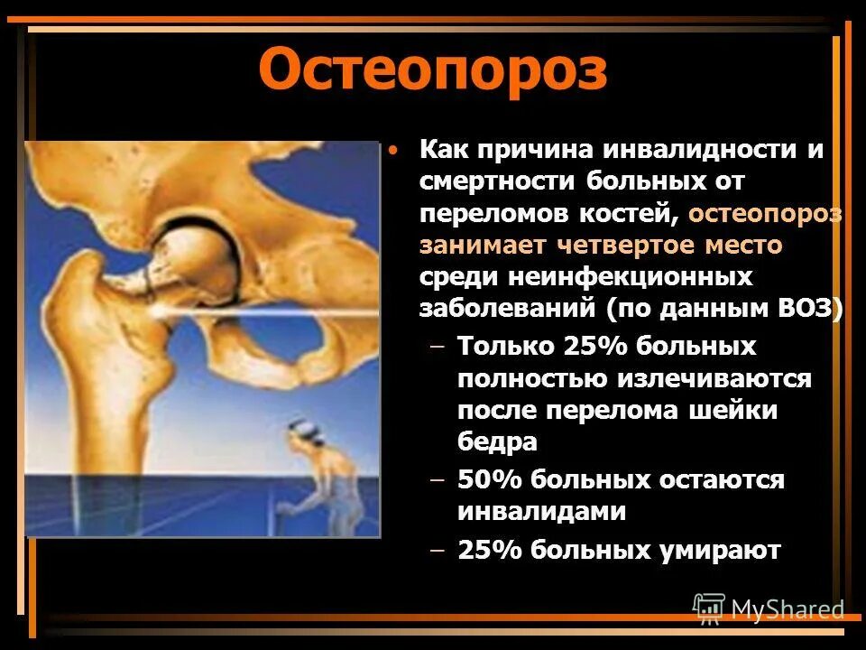 Инвалидность при остеопорозе