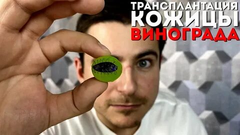 Хирурги виноград