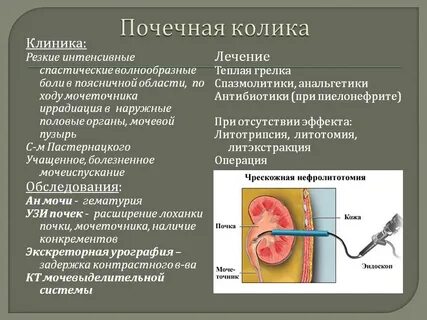 Больно писать почки