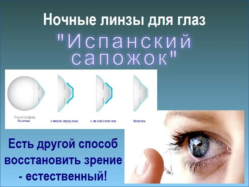 Как можно скорректировать зрение при помощи линз. Ночные ортокератологические линзы. Ортокератология ночные линзы. Ночные линзы для восстановления зрения. Исправление зрения линзами.