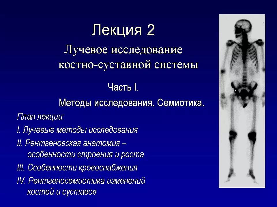 Методы исследования костной системы. Синдромы костно-суставной системы лучевая диагностика. лучевое исследование костно-суставной системы. лучевые методы исследования костно-суставного аппарата. лучевые методы исследования костно-суставной системы.