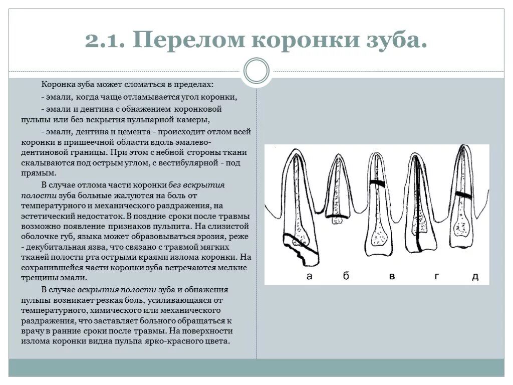 Перелом корня зуба симптомы и лечение фото Стоматология. Травма. Переломы. Переломы зубов. + Портал радиологов