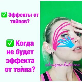 Схемы тейпирования от отеков