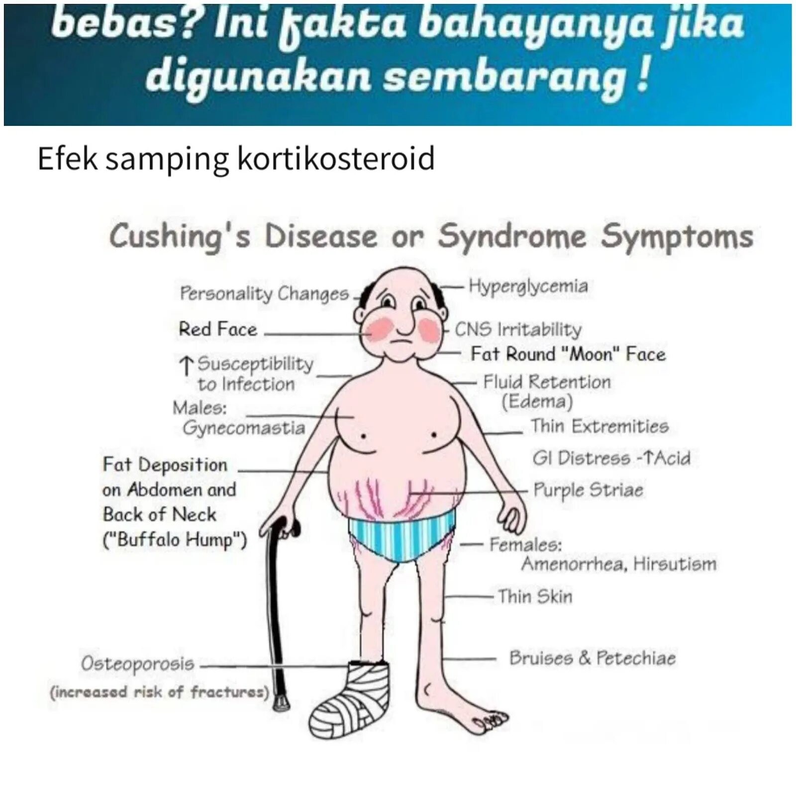 Синдром яценко-кушинга. Признаки проявления синдрома шерешевского. Характерные симптомы синдром шерешевского- тернера. Синдром харе. Синдром иценко -кушинга пациенты.