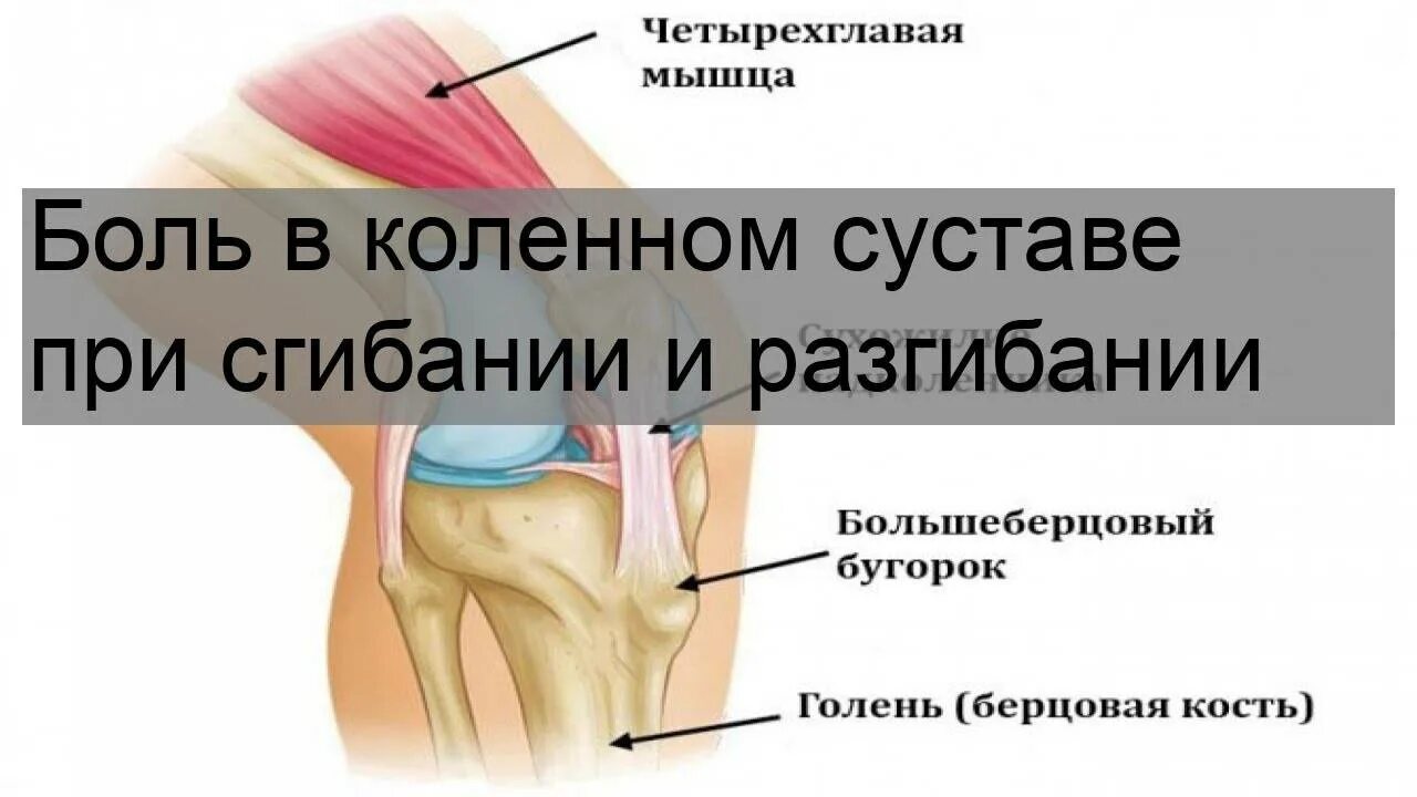 Сильно болят коленные суставы. Болит колено при сгибании. Боли в коленном суставе при сгибании и разгибании. Больно при разгибании колена. Коленный сустав при сгибании.