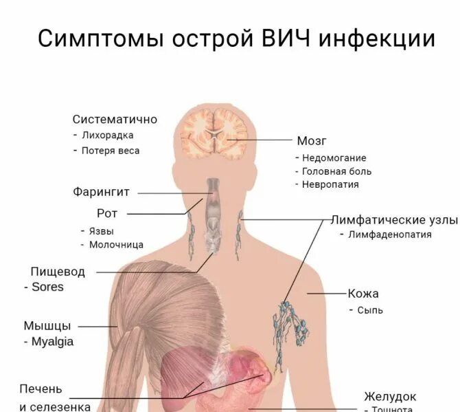 Мужские спид. Ранние симптомы ВИЧ инфекции. Первичные клинические проявления ВИЧ инфекции. Острая стадия ВИЧ симптомы. 1 Симптомы ВИЧ инфекции.